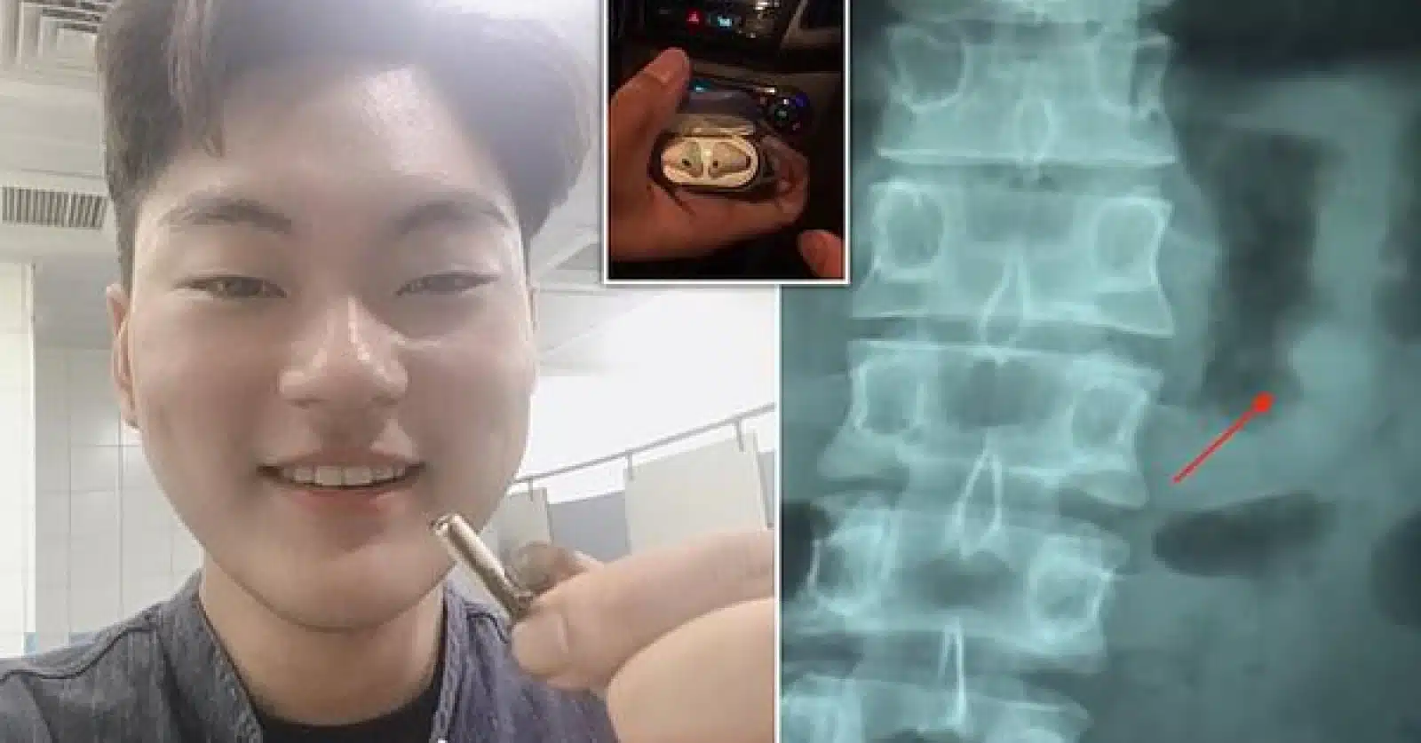 swallowing airpods